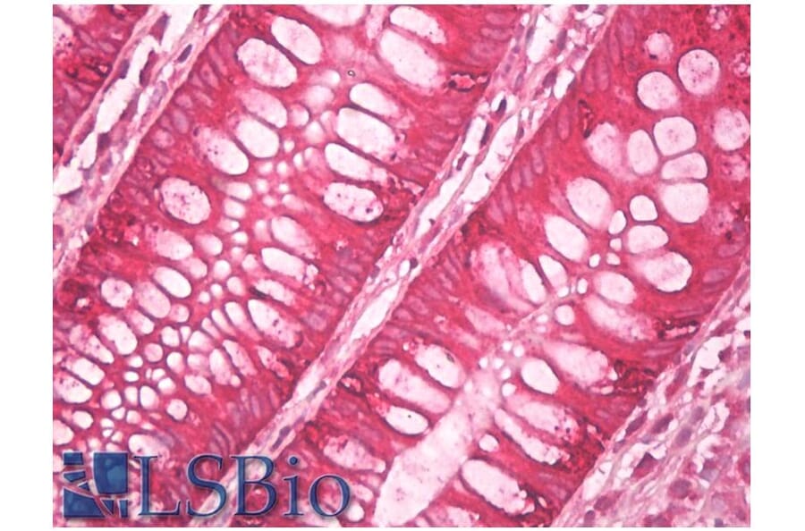 IHC - Anti-AGR2 + AGR3 Antibody [AGR3.4] (A86377)