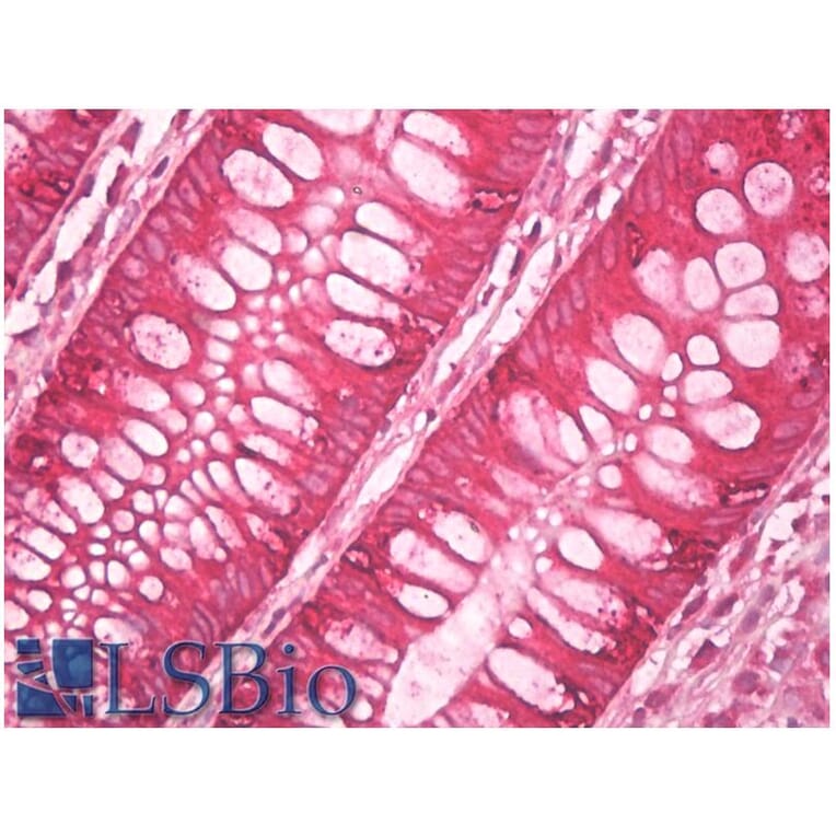 IHC - Anti-AGR2 + AGR3 Antibody [AGR3.4] (A86377)