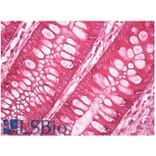 IHC - Anti-AGR2 + AGR3 Antibody [AGR3.4] (A86377)