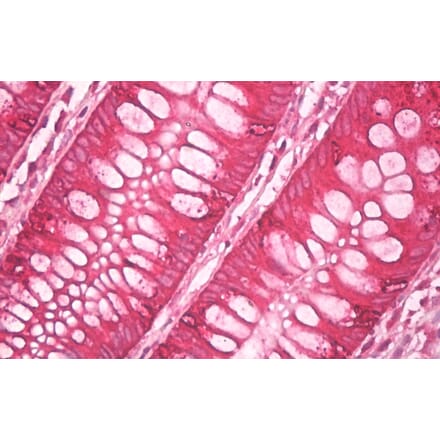 Immunohistochemistry - Anti-AGR2 + AGR3 Antibody [AGR3.4] (A86376) - Antibodies.com