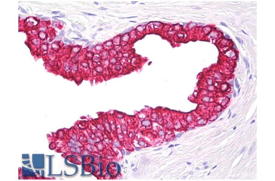 IHC - Anti-Cytokeratin 5 + 18 Antibody [C-50] (A86386)