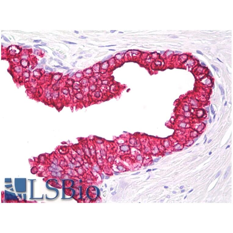 IHC - Anti-Cytokeratin 5 + 18 Antibody [C-50] (A86386)