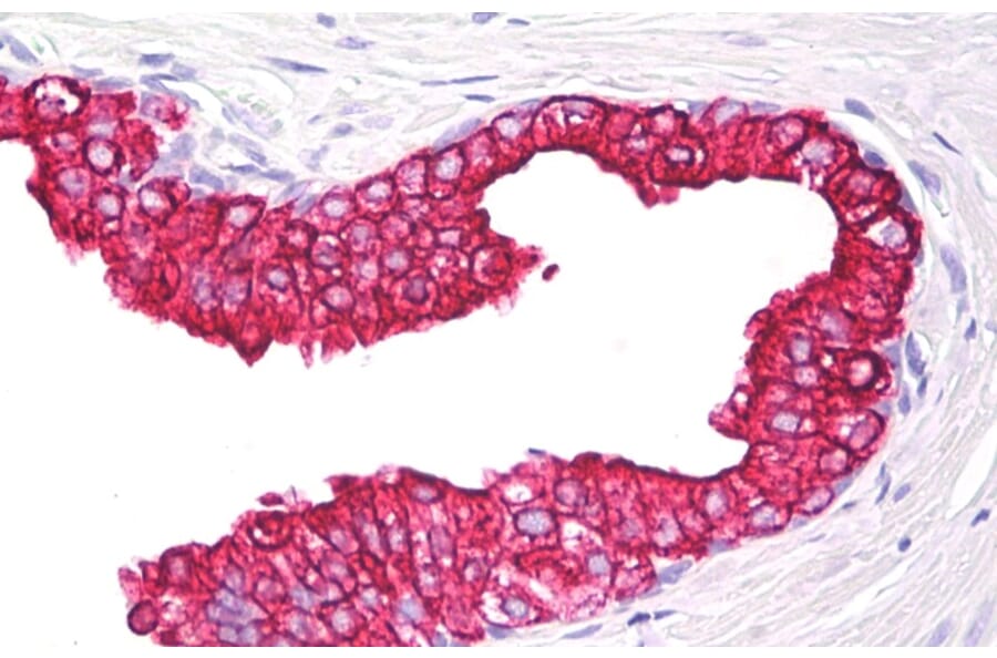 Immunohistochemistry - Anti-Cytokeratin 5 + 18 Antibody [C-50] (A86385) - Antibodies.com