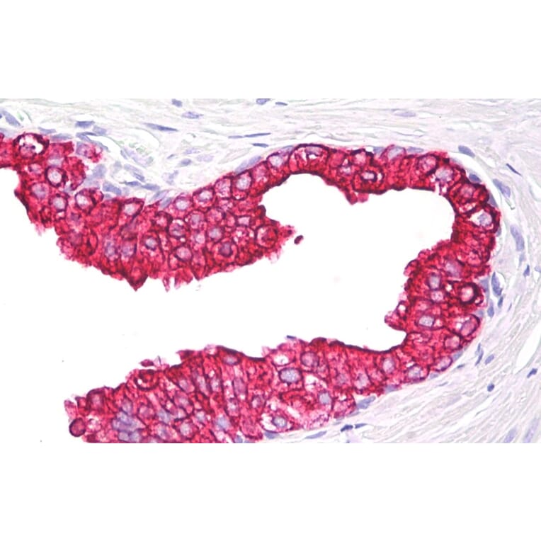 Immunohistochemistry - Anti-Cytokeratin 5 + 18 Antibody [C-50] (A86385) - Antibodies.com