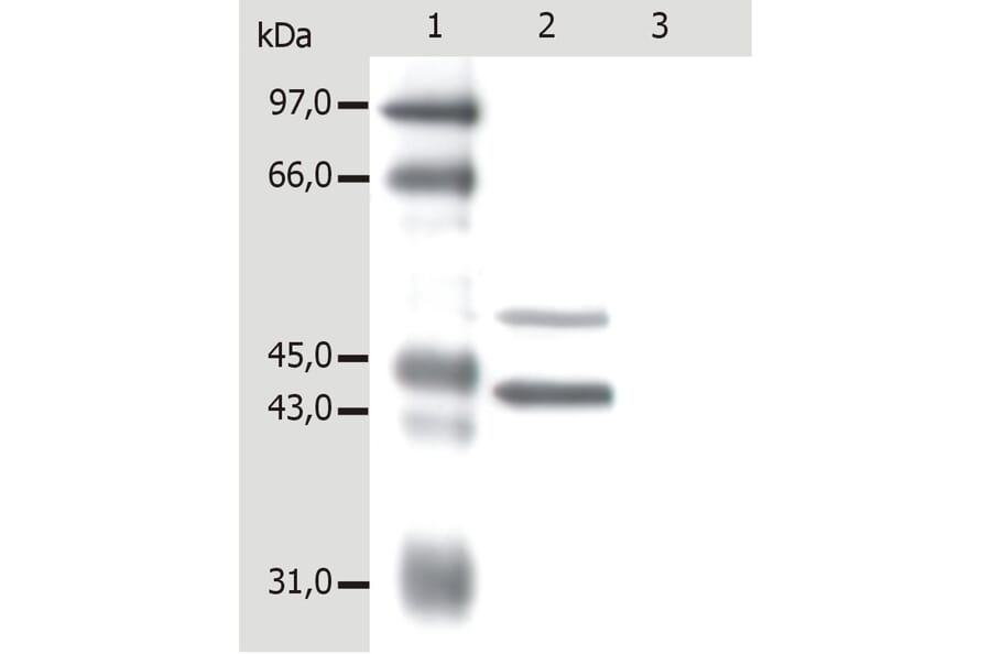 Western Blot - Anti-Cytokeratin 5 + 18 Antibody [C-50] (A86386) - Antibodies.com