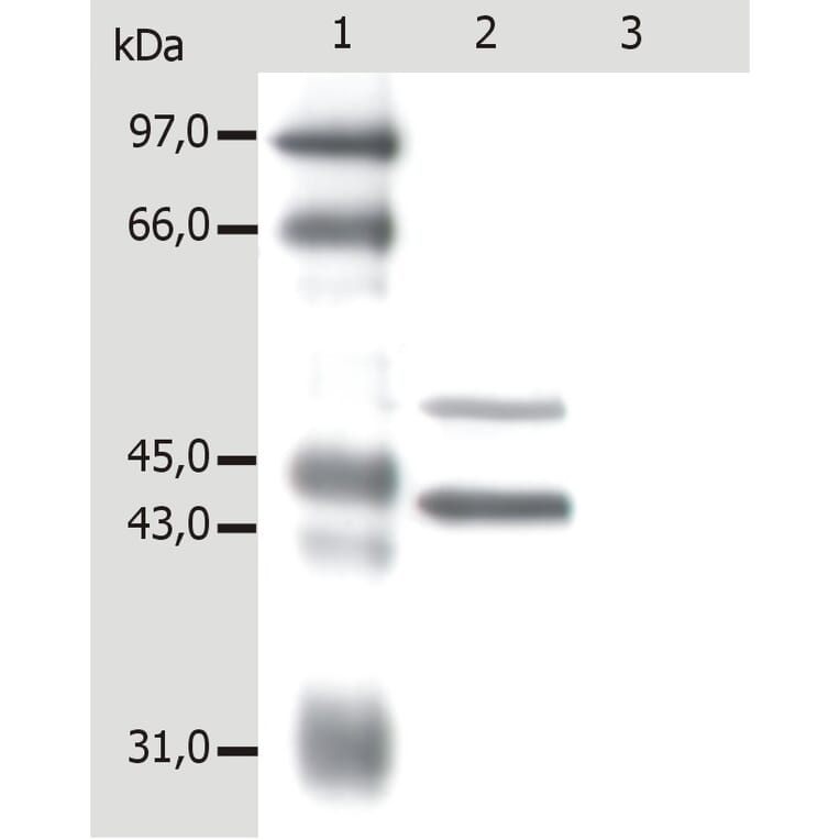 Western Blot - Anti-Cytokeratin 5 + 18 Antibody [C-50] (A86386) - Antibodies.com