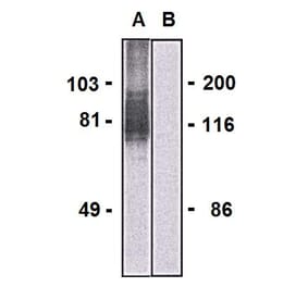 Western Blot - Anti-LARGE1 Antibody [LARGE-02] (A86413) - Antibodies.com