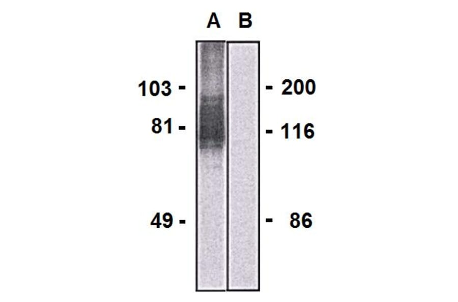 Western Blot - Anti-LARGE1 Antibody [LARGE-02] (A86413) - Antibodies.com