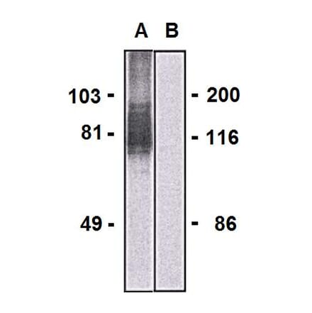 Western Blot - Anti-LARGE1 Antibody [LARGE-02] (A86413) - Antibodies.com