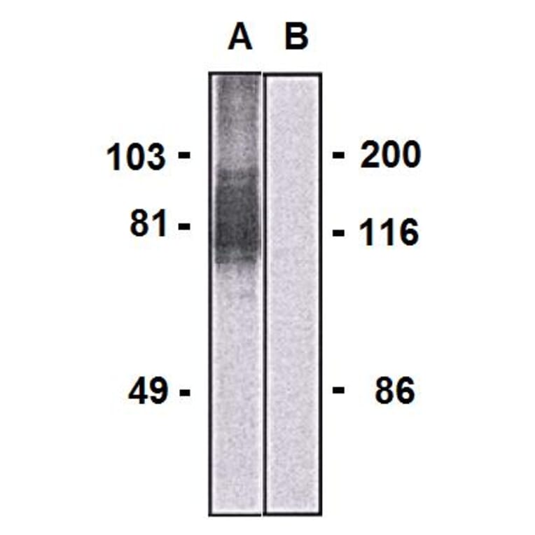 Western Blot - Anti-LARGE1 Antibody [LARGE-02] (A86413) - Antibodies.com