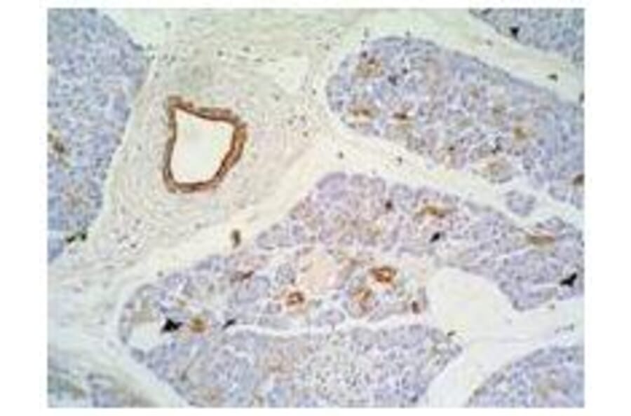 IHC - Anti-Cytokeratin 7 + 17 Antibody [C-46] (A86418)