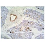 IHC - Anti-Cytokeratin 7 + 17 Antibody [C-46] (A86418)