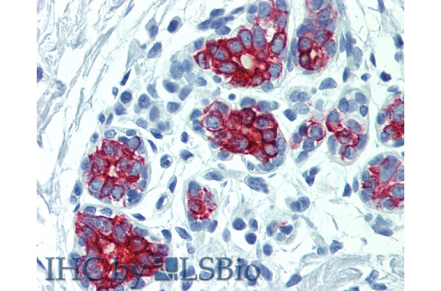 IHC - Anti-Cytokeratin 7 + 17 Antibody [C-46] (A86418)