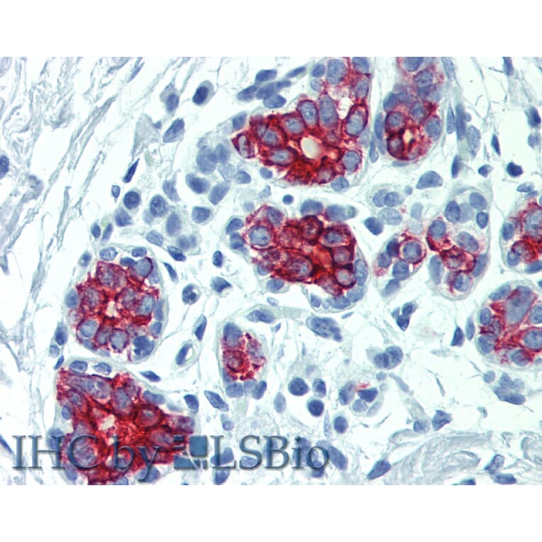 IHC - Anti-Cytokeratin 7 + 17 Antibody [C-46] (A86418)