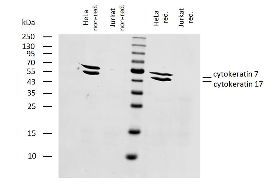 WB - Anti-Cytokeratin 7 + 17 Antibody [C-46] (A86418)
