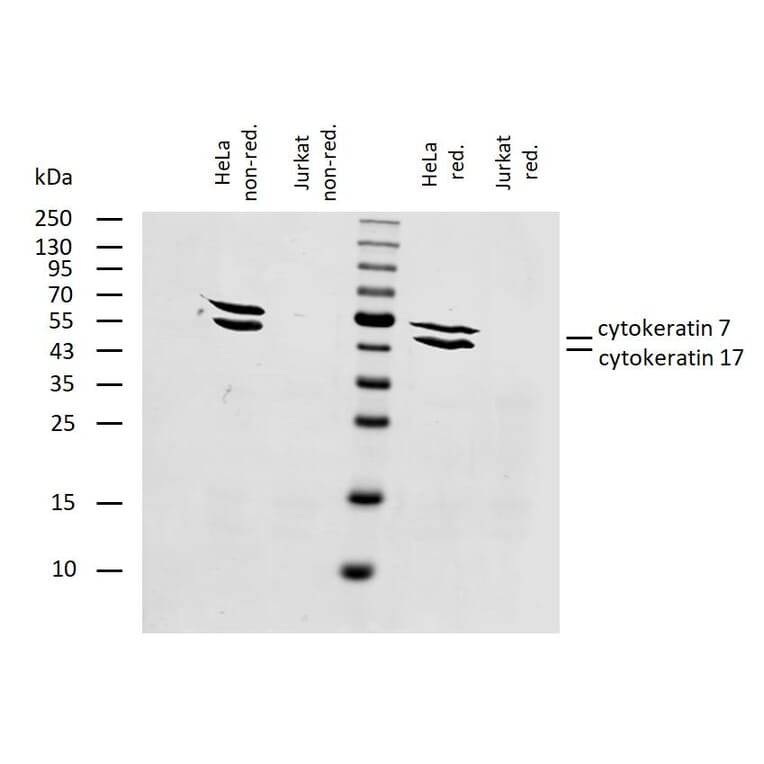 WB - Anti-Cytokeratin 7 + 17 Antibody [C-46] (A86418)