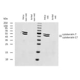 WB - Anti-Cytokeratin 7 + 17 Antibody [C-46] (A86418)