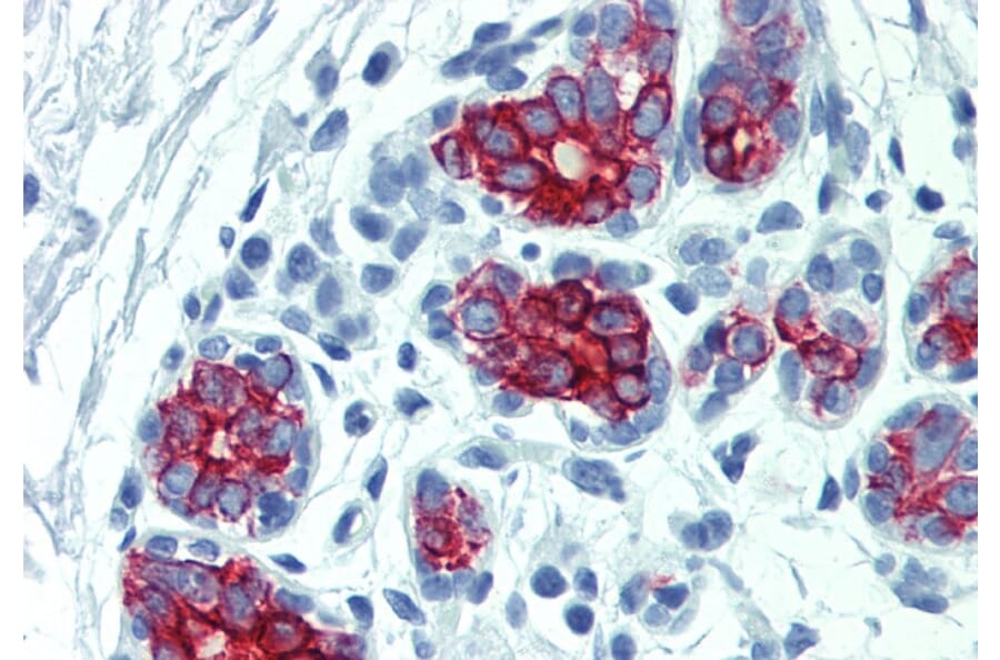 Immunohistochemistry - Anti-Cytokeratin 7 + 17 Antibody [C-46] (A86417) - Antibodies.com