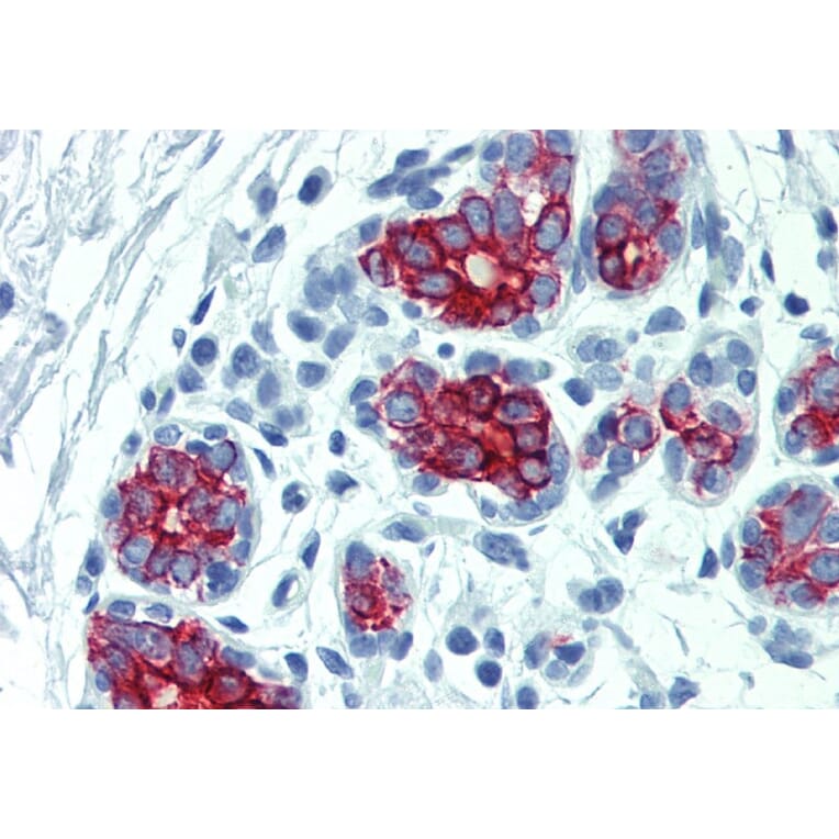 Immunohistochemistry - Anti-Cytokeratin 7 + 17 Antibody [C-46] (A86417) - Antibodies.com