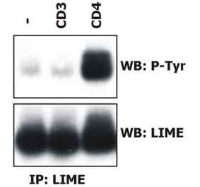 IP - Anti-LIME Antibody [LIME-06] (A86419)