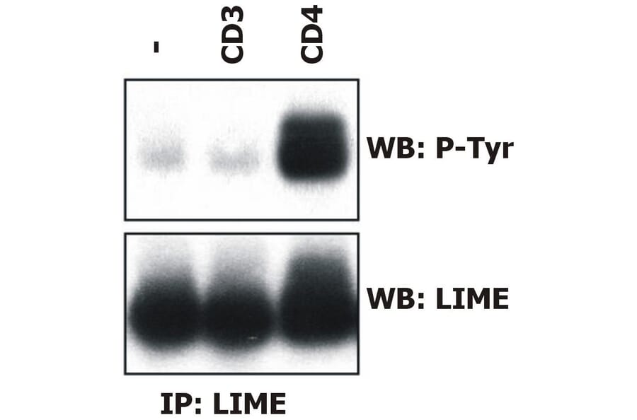 IP - Anti-LIME Antibody [LIME-06] (A86419)