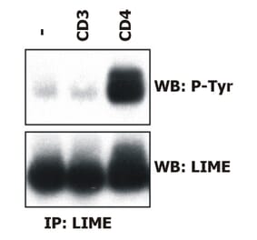 Immunoprecipitation - Anti-LIME Antibody [LIME-06] (A86418) - Antibodies.com