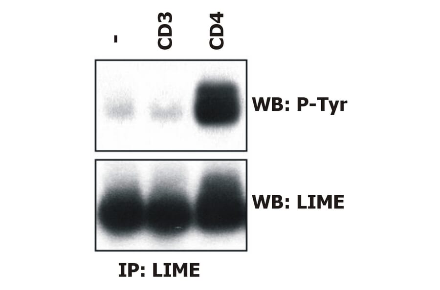 Immunoprecipitation - Anti-LIME Antibody [LIME-06] (A86418) - Antibodies.com