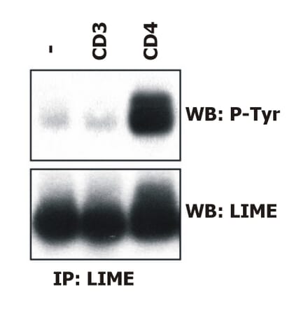 Immunoprecipitation - Anti-LIME Antibody [LIME-06] (A86418) - Antibodies.com
