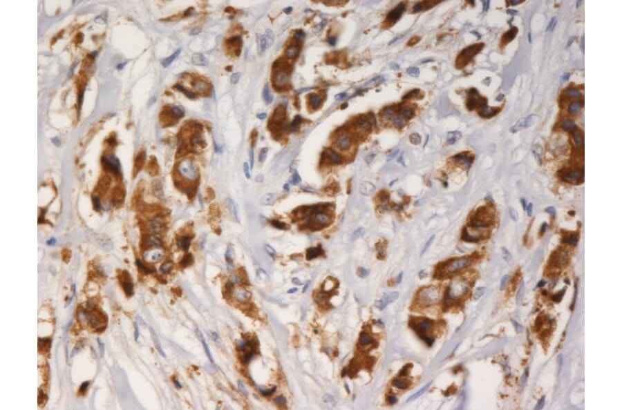 Immunohistochemistry - Anti-AGR3 Antibody [AGR3.1] (A86423) - Antibodies.com