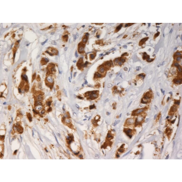 Immunohistochemistry - Anti-AGR3 Antibody [AGR3.1] (A86423) - Antibodies.com