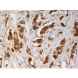 Immunohistochemistry - Anti-AGR3 Antibody [AGR3.1] (A86423) - Antibodies.com