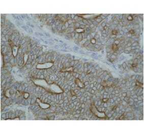 IHC - Anti-pan Cytokeratin Antibody [C-11] (A86447)