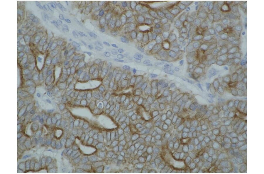 IHC - Anti-pan Cytokeratin Antibody [C-11] (A86447)