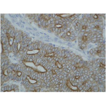 IHC - Anti-pan Cytokeratin Antibody [C-11] (A86447)