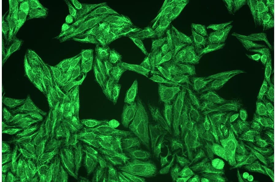 ICC - Anti-pan Cytokeratin Antibody [C-11] (A86447)