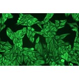 ICC - Anti-pan Cytokeratin Antibody [C-11] (A86447)
