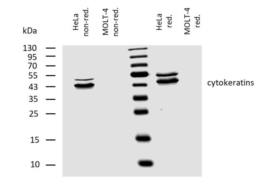 WB - Anti-pan Cytokeratin Antibody [C-11] (A86447)