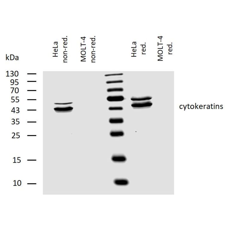 WB - Anti-pan Cytokeratin Antibody [C-11] (A86447)