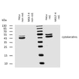 WB - Anti-pan Cytokeratin Antibody [C-11] (A86447)