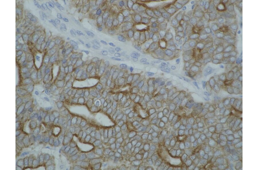 Immunohistochemistry - Anti-pan Cytokeratin Antibody [C-11] (A86445) - Antibodies.com