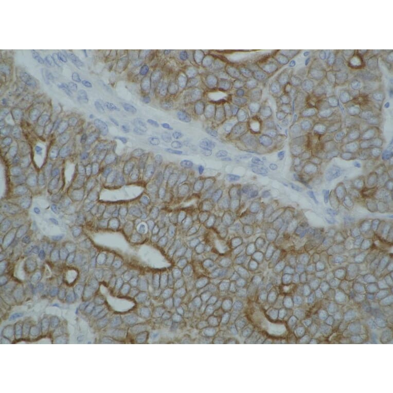 Immunohistochemistry - Anti-pan Cytokeratin Antibody [C-11] (A86445) - Antibodies.com