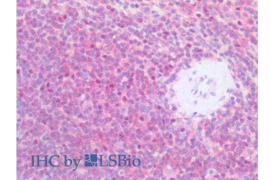 IHC - Anti-CD79b Antibody [CB3-1] (A86460)