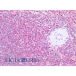 IHC - Anti-CD79b Antibody [CB3-1] (A86460)