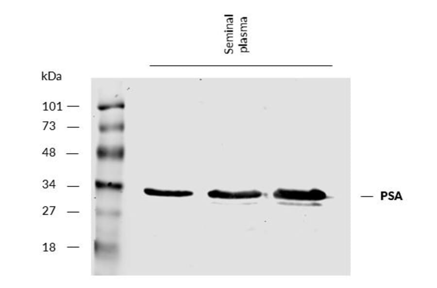 WB - Anti-Prostate Specific Antigen Antibody [A67-B/E3] (A86464)