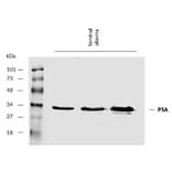 WB - Anti-Prostate Specific Antigen Antibody [A67-B/E3] (A86464)