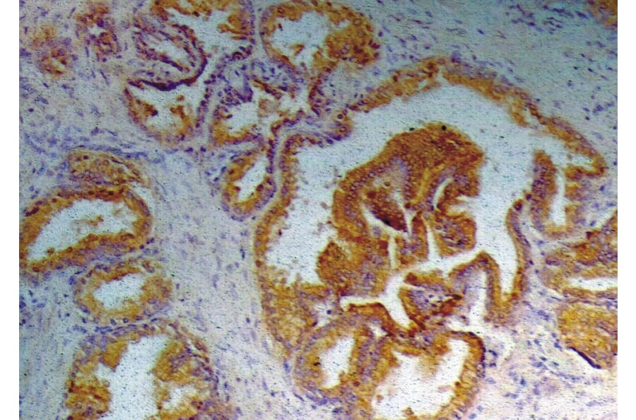 Immunohistochemistry - Anti-Prostate Specific Antigen Antibody [A67-B/E3] (A86460) - Antibodies.com