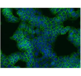 ICC - Anti-beta Catenin Antibody [EM-22] (A86465)