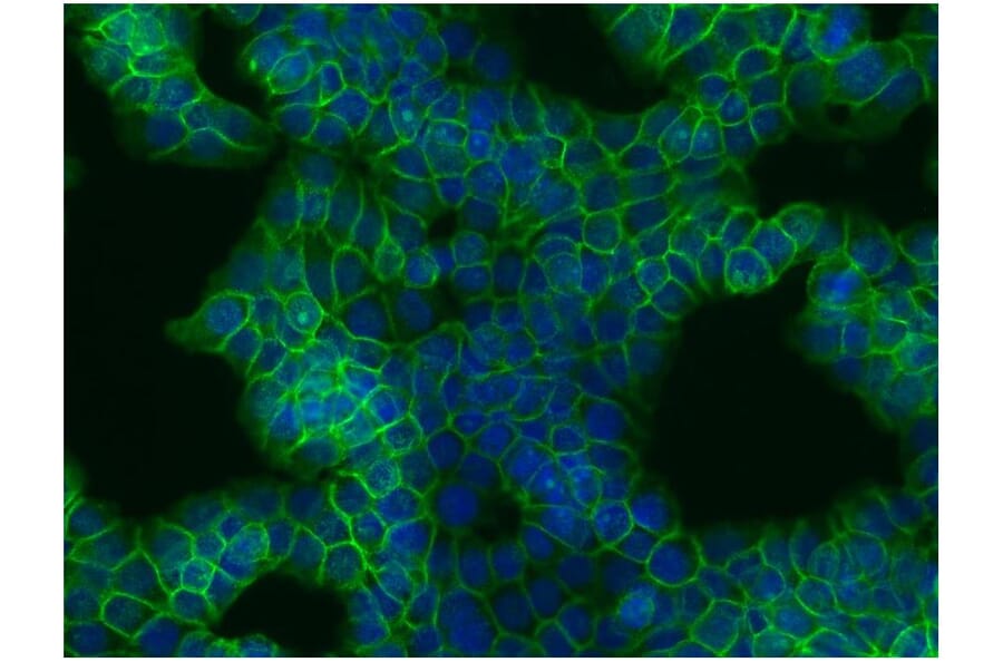 ICC - Anti-beta Catenin Antibody [EM-22] (A86465)