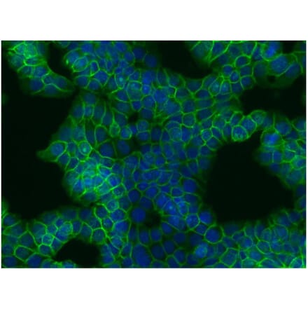 ICC - Anti-beta Catenin Antibody [EM-22] (A86465)