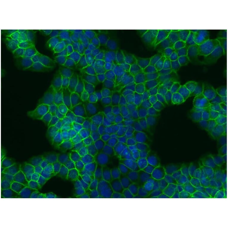 ICC - Anti-beta Catenin Antibody [EM-22] (A86465)